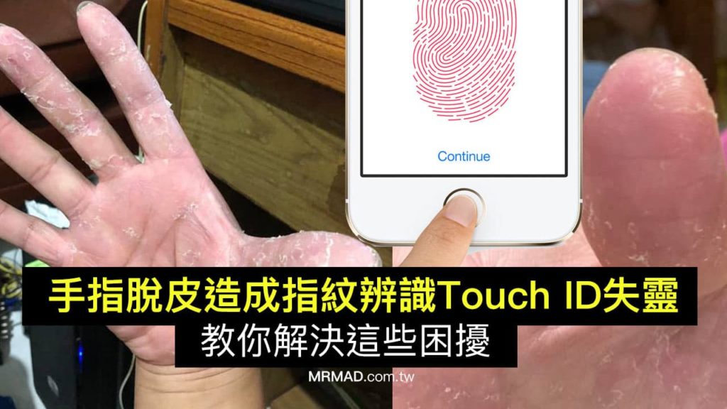 手指脫皮造成 Touch ID 指紋辨識失靈該怎麼辦？透過這幾招解決