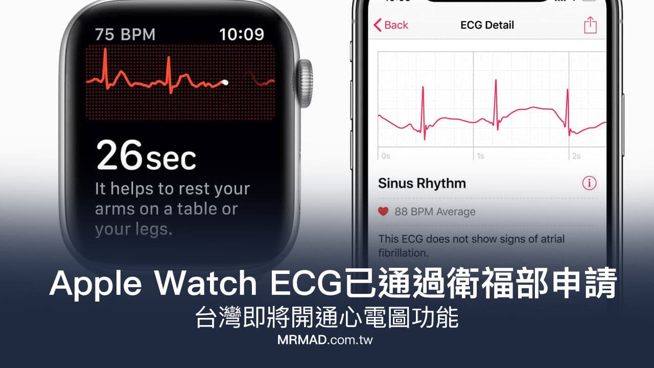 Apple Watch ECG 已通過衛福部申請，台灣即將開通心電圖