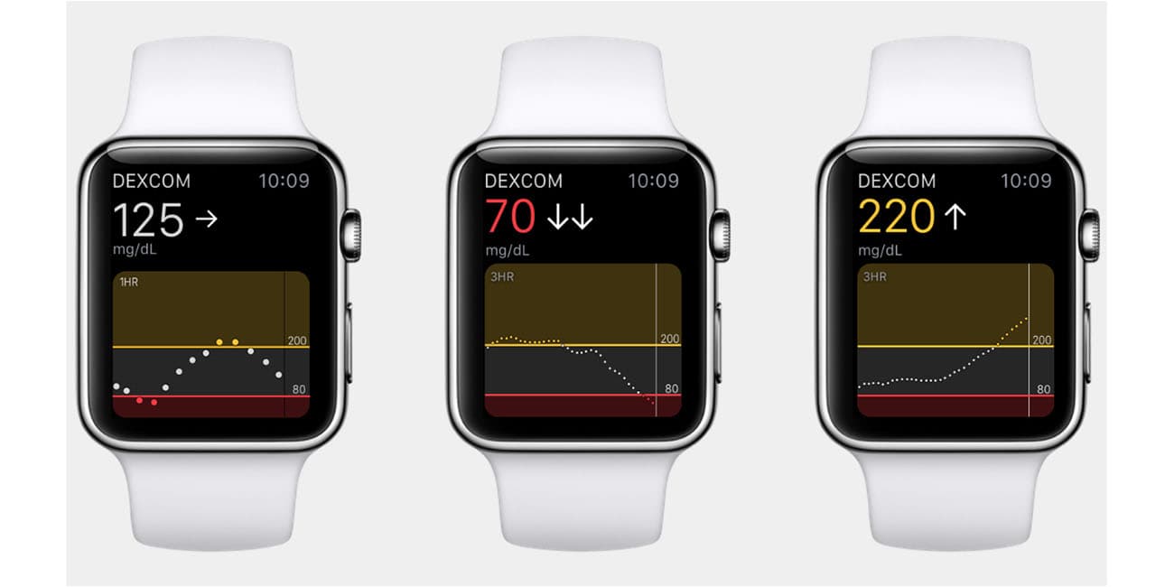 Apple Watch 血糖檢測功能模擬