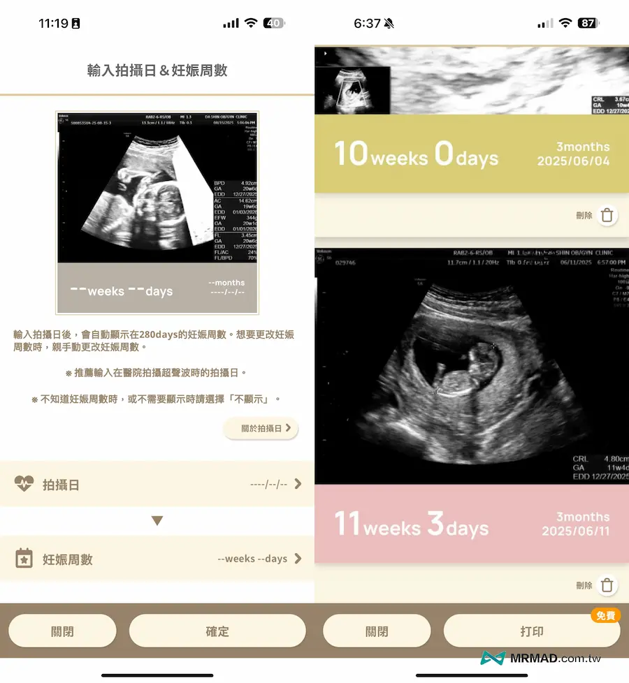 懷孕APP技巧11：超音波照片紀錄 2