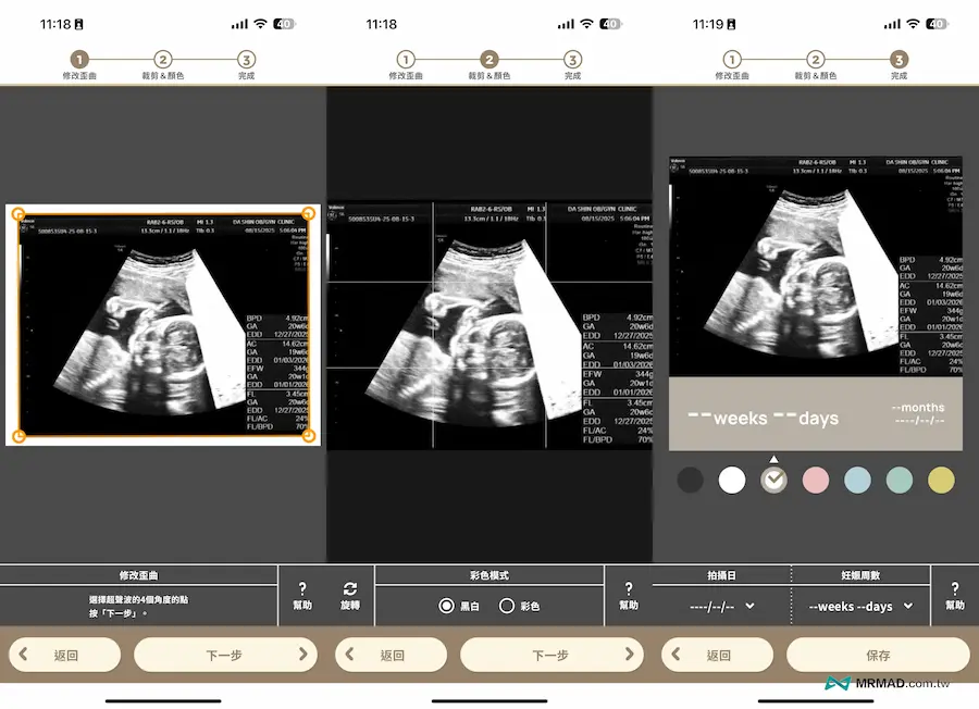 懷孕APP技巧11：超音波照片紀錄 1