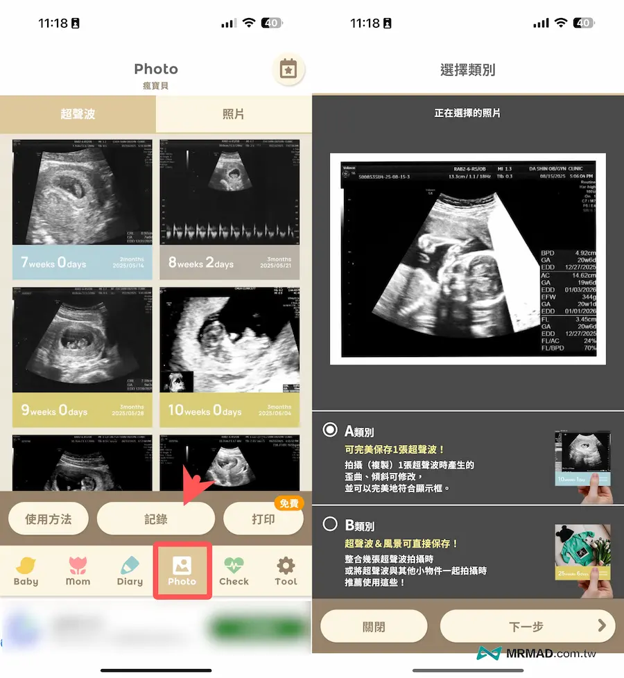 懷孕APP技巧11：超音波照片紀錄