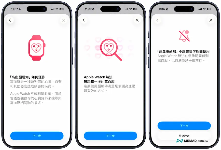 支援Apple Watch高血壓機型和限制